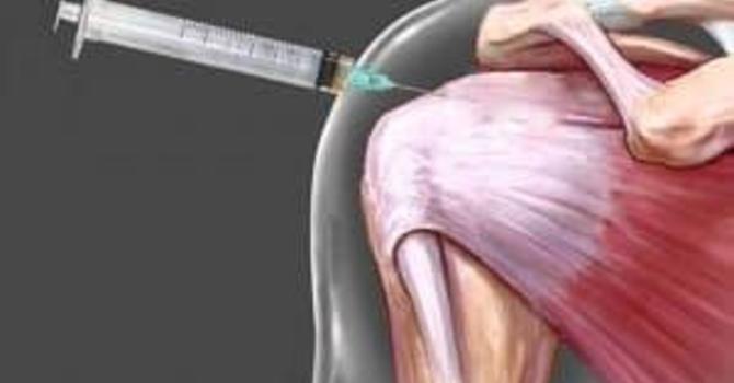 Injections for Pain: Truths and Fallacies image