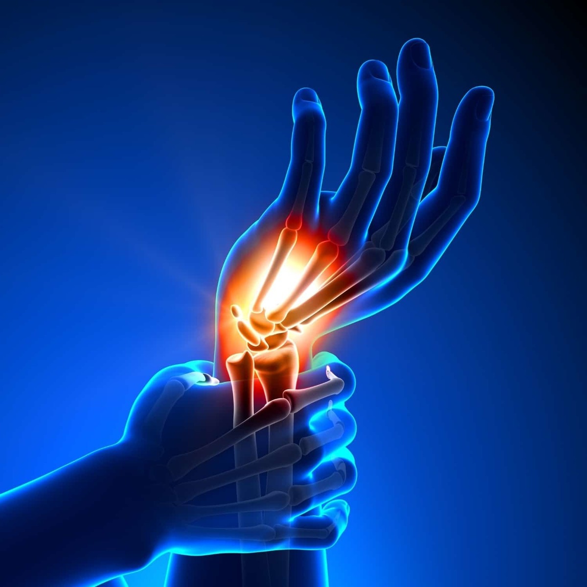 Wrist Injuries Are a PAIN | Laser Therapy | Strength & Spine Chiropractic