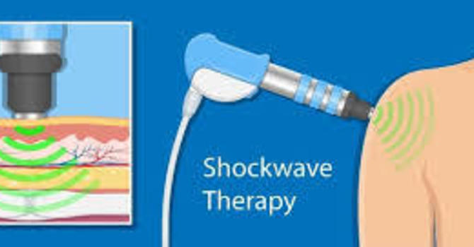 Shockwave and Shoulder Pain-The Results You’ve Been Waiting For image