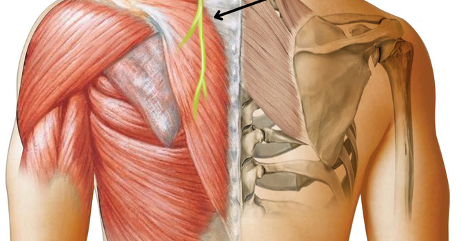 Pain in Between the Shoulder Blades image